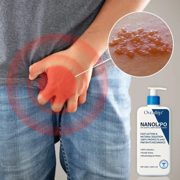 Homme gêné, la main posée sur la zone intime, et tube de crème NanoLipo HPV