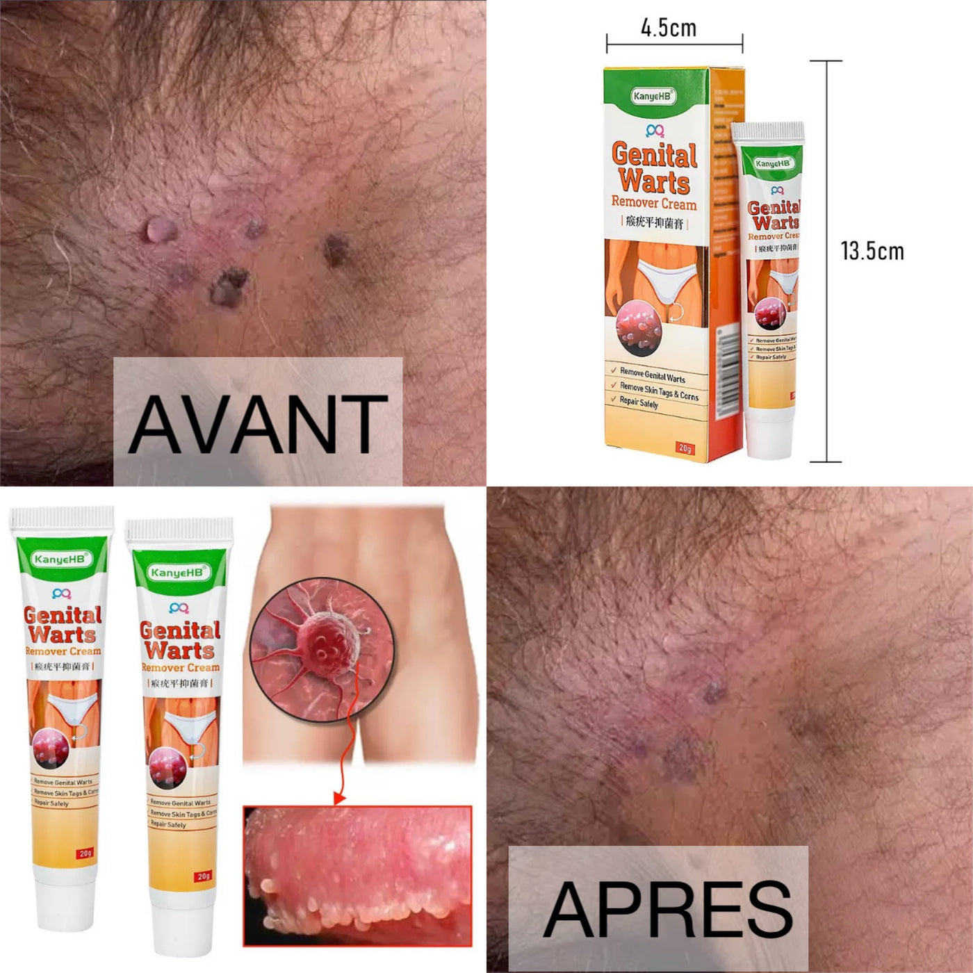 Comparaison des cheveux avec VAROSIA