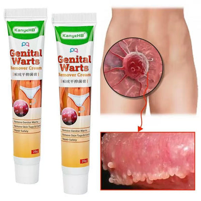 Crème Anti Verrues