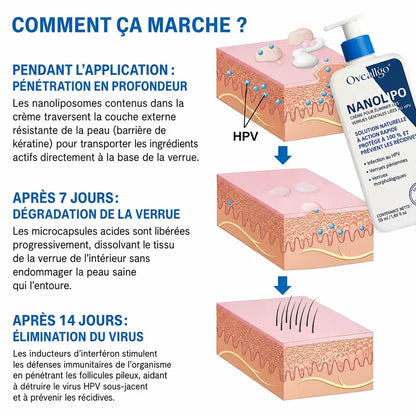 NanoLipo HPV Crème Effaceur de Verrues Génitales