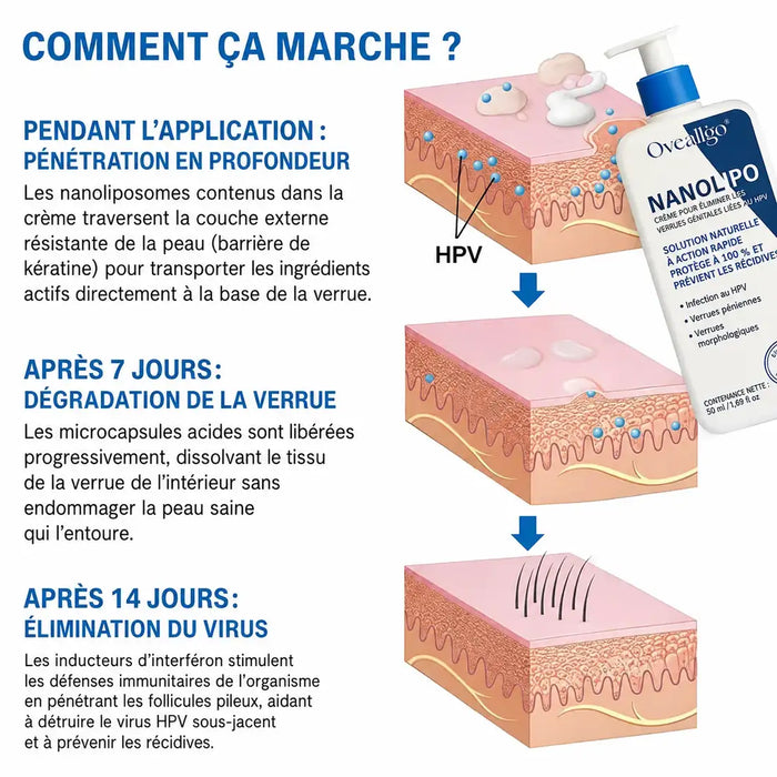 Votre solution