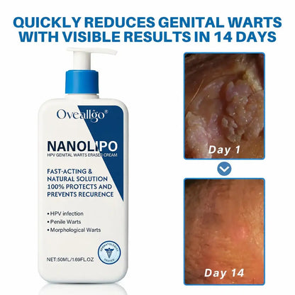NanoLipo HPV Crème Effaceur de Verrues Génitales